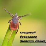 Болезнь Лайма
