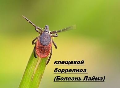 Болезнь Лайма